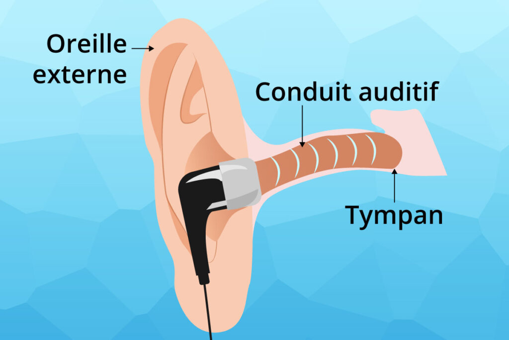 placement_diagram